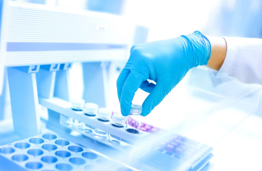 Automatisierte Dosiersysteme für Liquid Handling